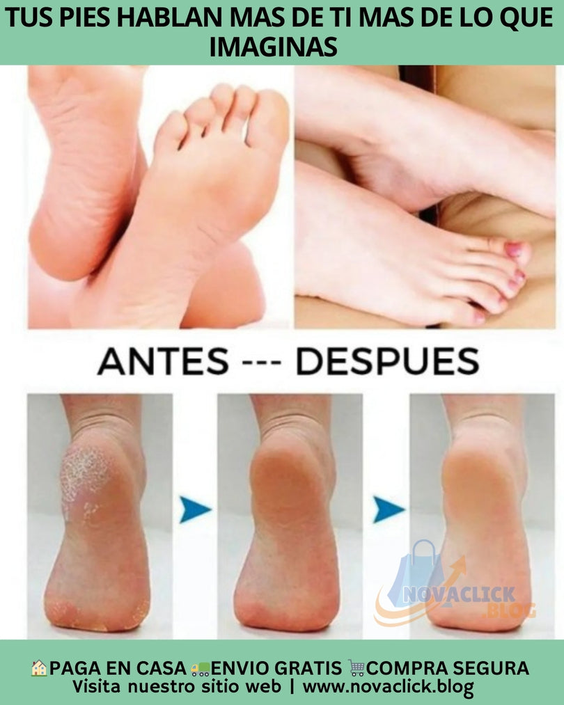 Crema Urea al 40%  Pies, manos y codos
