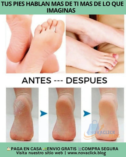 Crema Urea al 40%  Pies, manos y codos